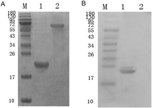Sturgeon disease-resistant immune protein and preparation method and application thereof