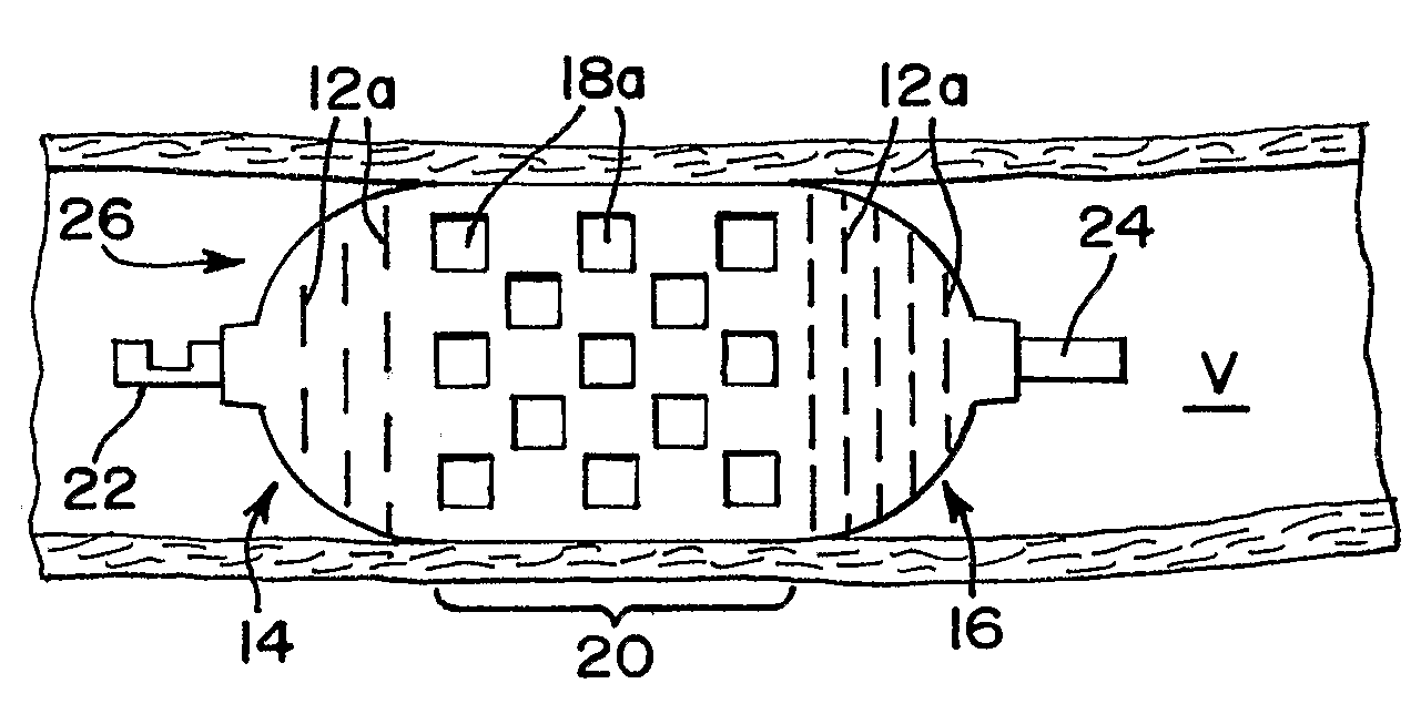 Thin Film Devices for Temporary or Permanent Occlusion of a Vessel