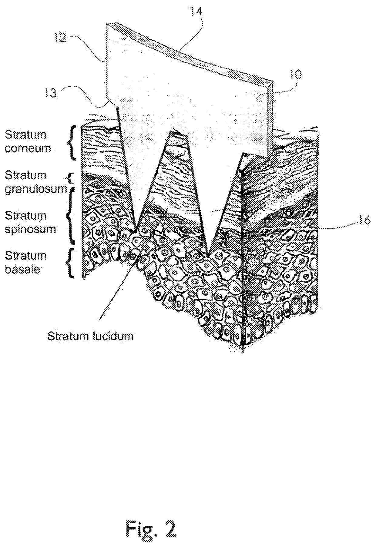 Physiological recording device or electrode