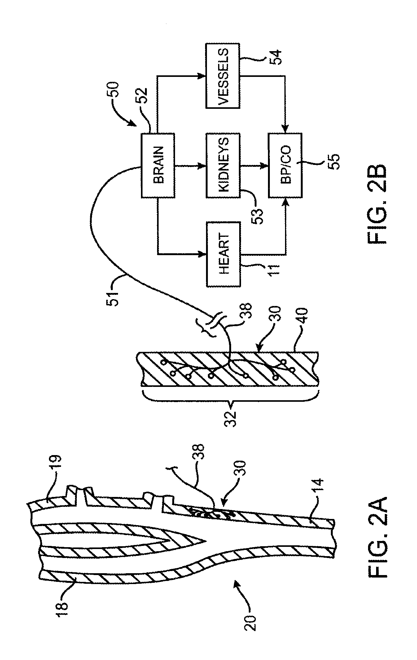 Electrode structures and methods for their use in cardiovascular reflex control