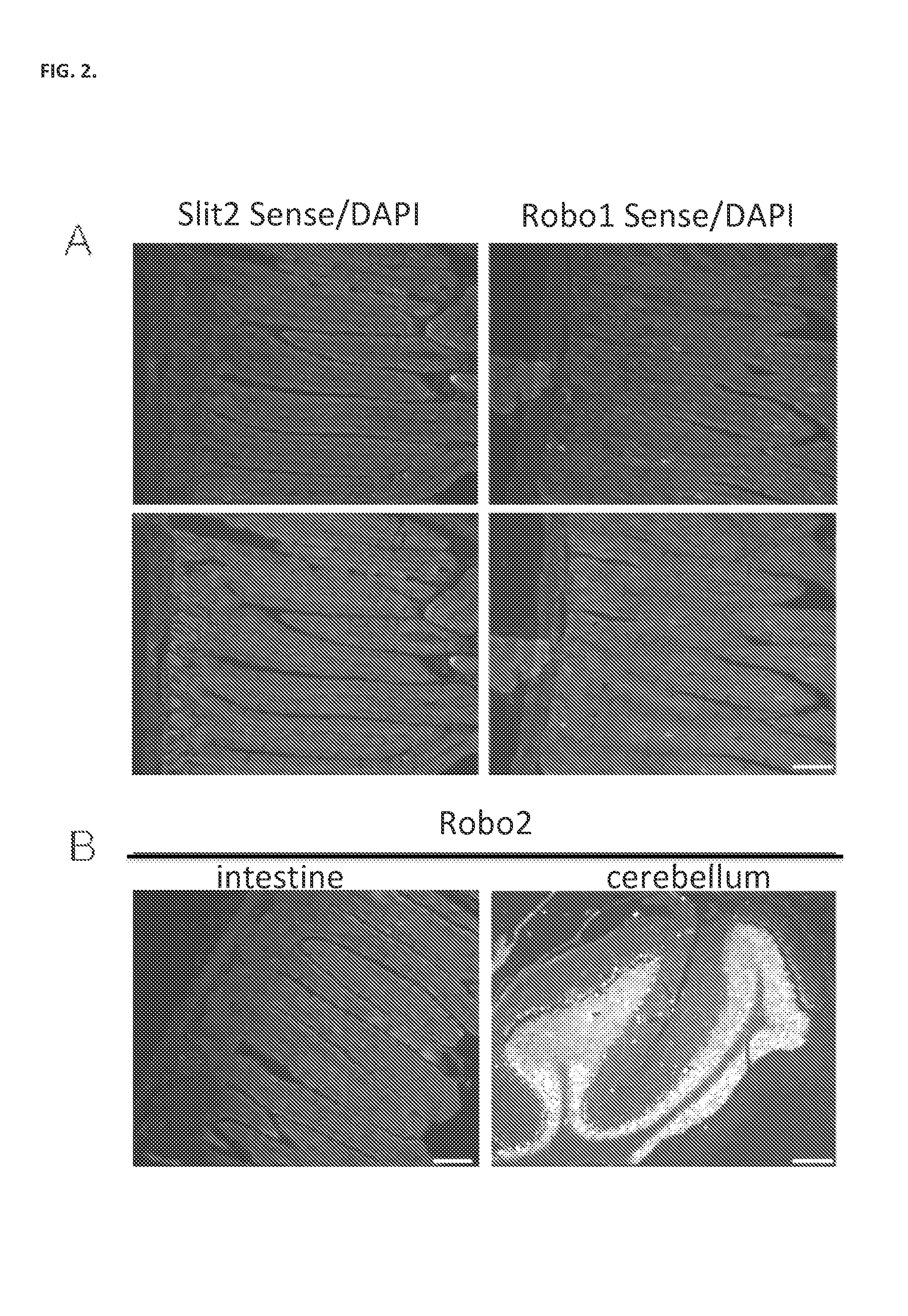 Compositions and methods relating to induction of intestinal stem cell homeogenesis and/or regeneration