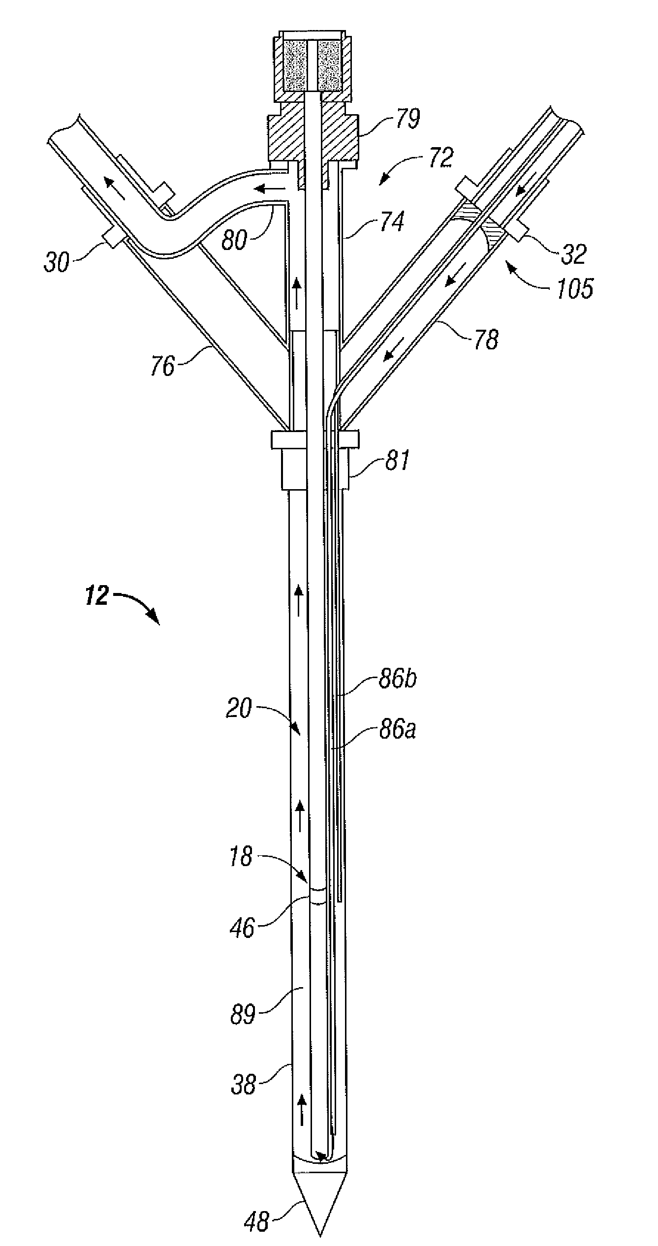 Microwave Antenna