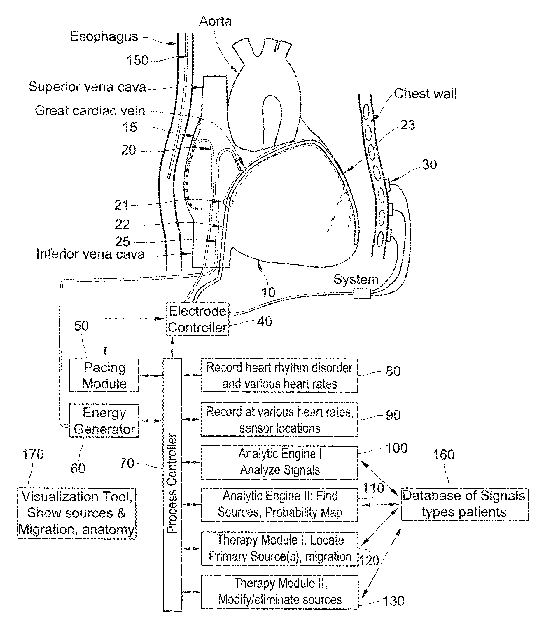 Methods for the detection and/or diagnosis of biological rhythm disorders