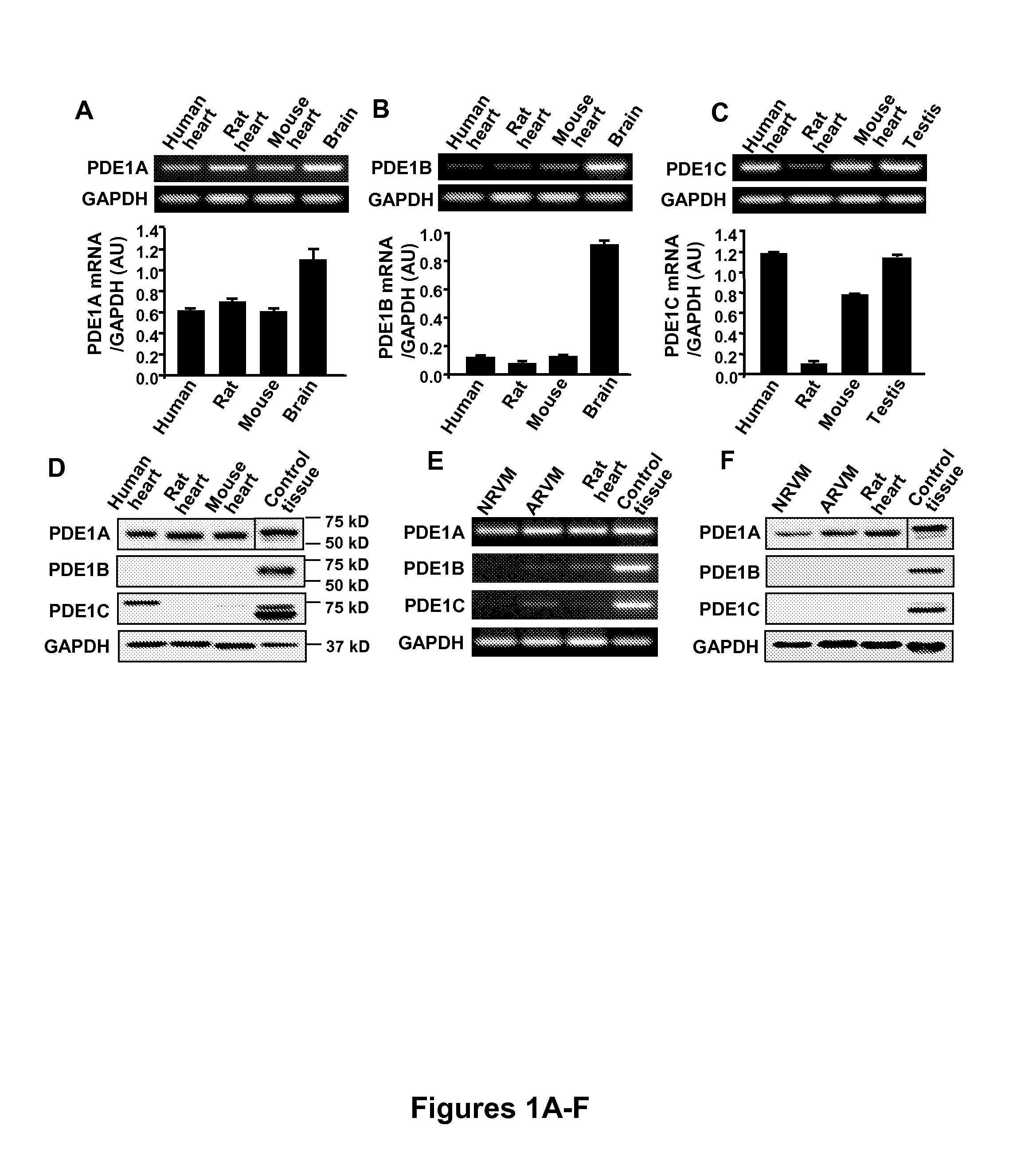 Methods and compositions for the treatment or prevention of pathological cardiac remodeling and heart failure