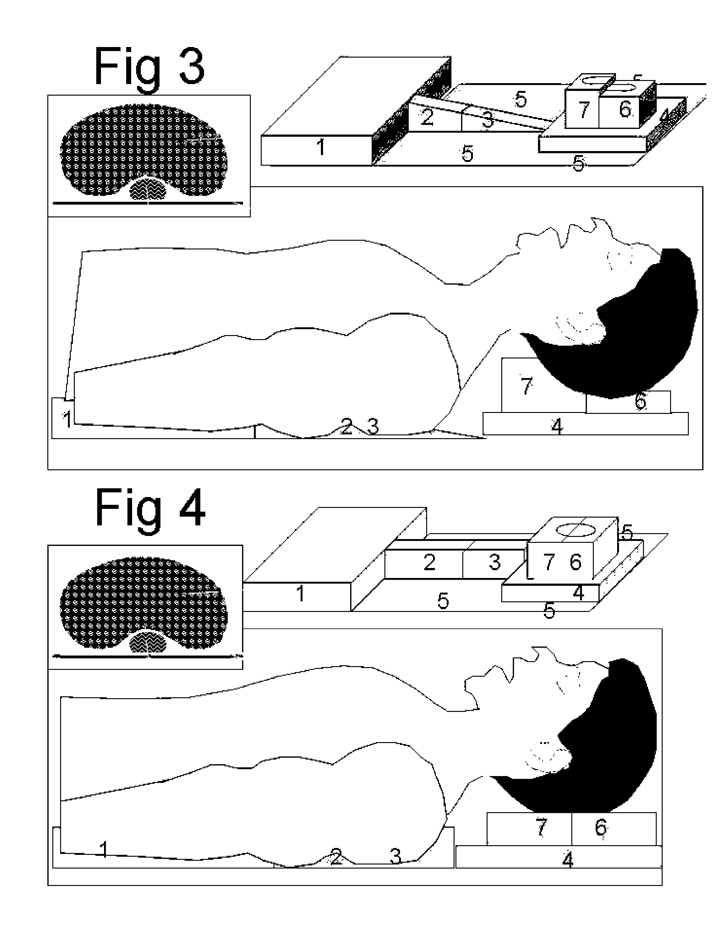 Intubation positioning, breathing facilitator and non-invasive assist ventilation device