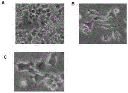 Method for separating out and purifying Kupffer cells in livers