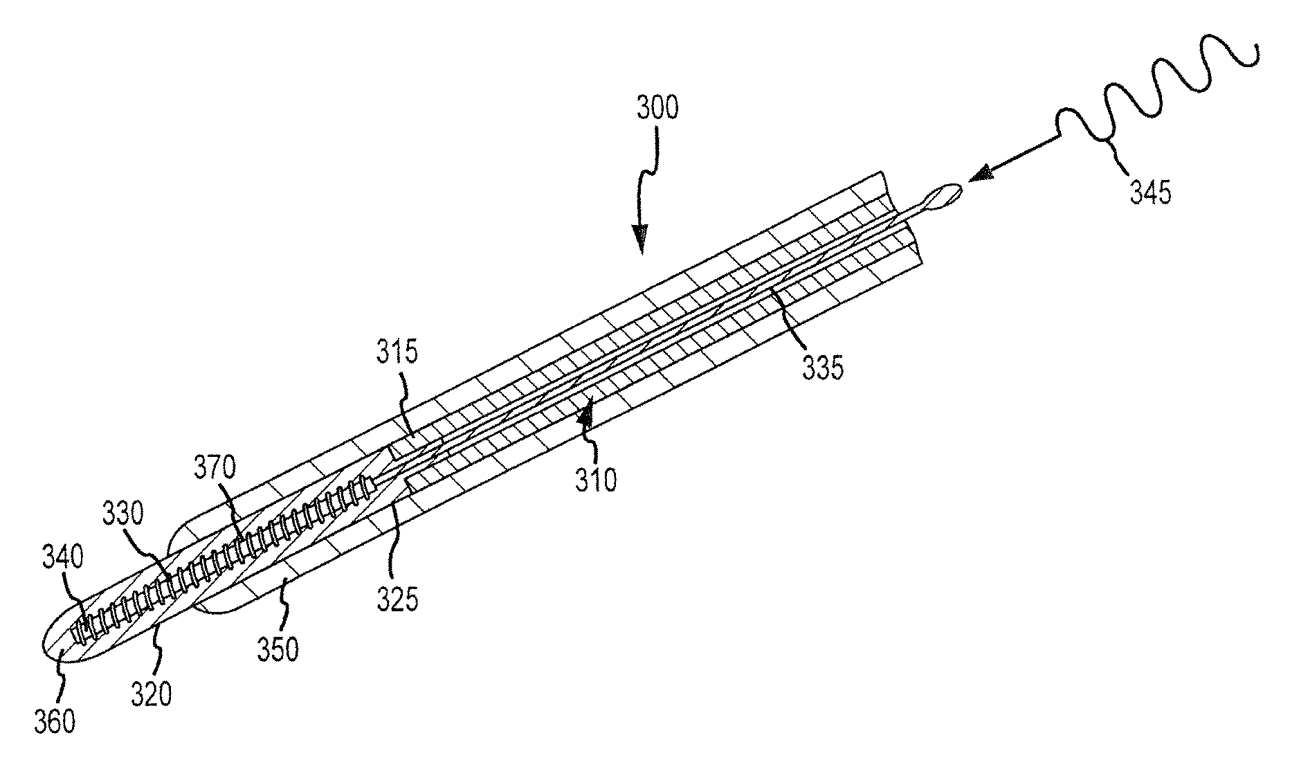 Adjustable length flexible polymer electrode catheter and method for ablation