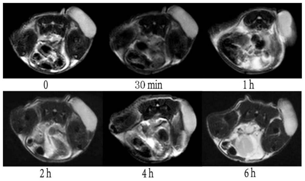 Magnetic resonance molecular probe for detecting early hepatocellular carcinoma