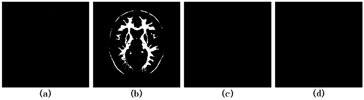 Non-rigid multi-modality medical image registration method based on discrete optimization of ZMLD (Zernike Moments based Local Descriptor) and GC (Graph Cuts)