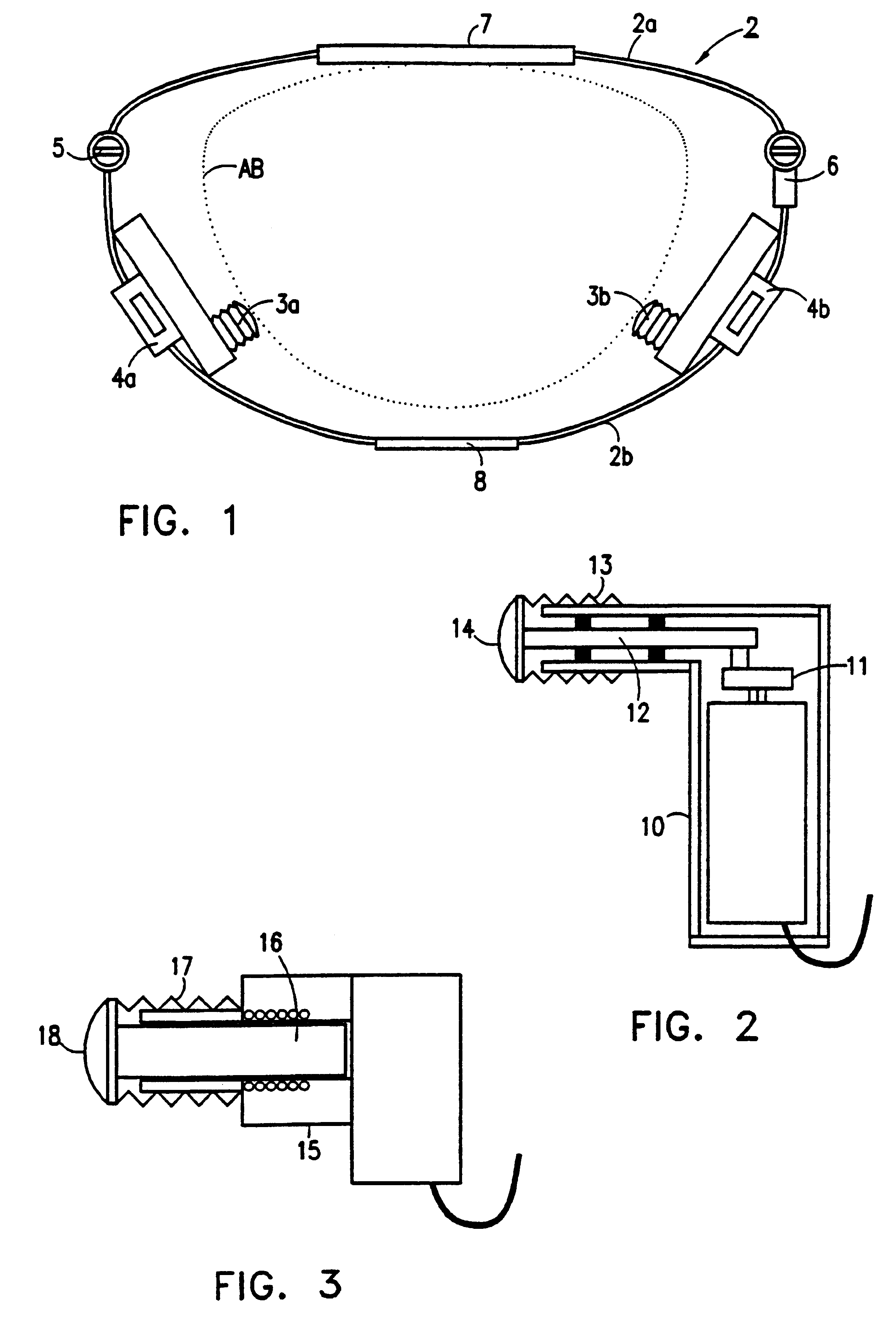 Vibrator appliance particularly useful for dialysis