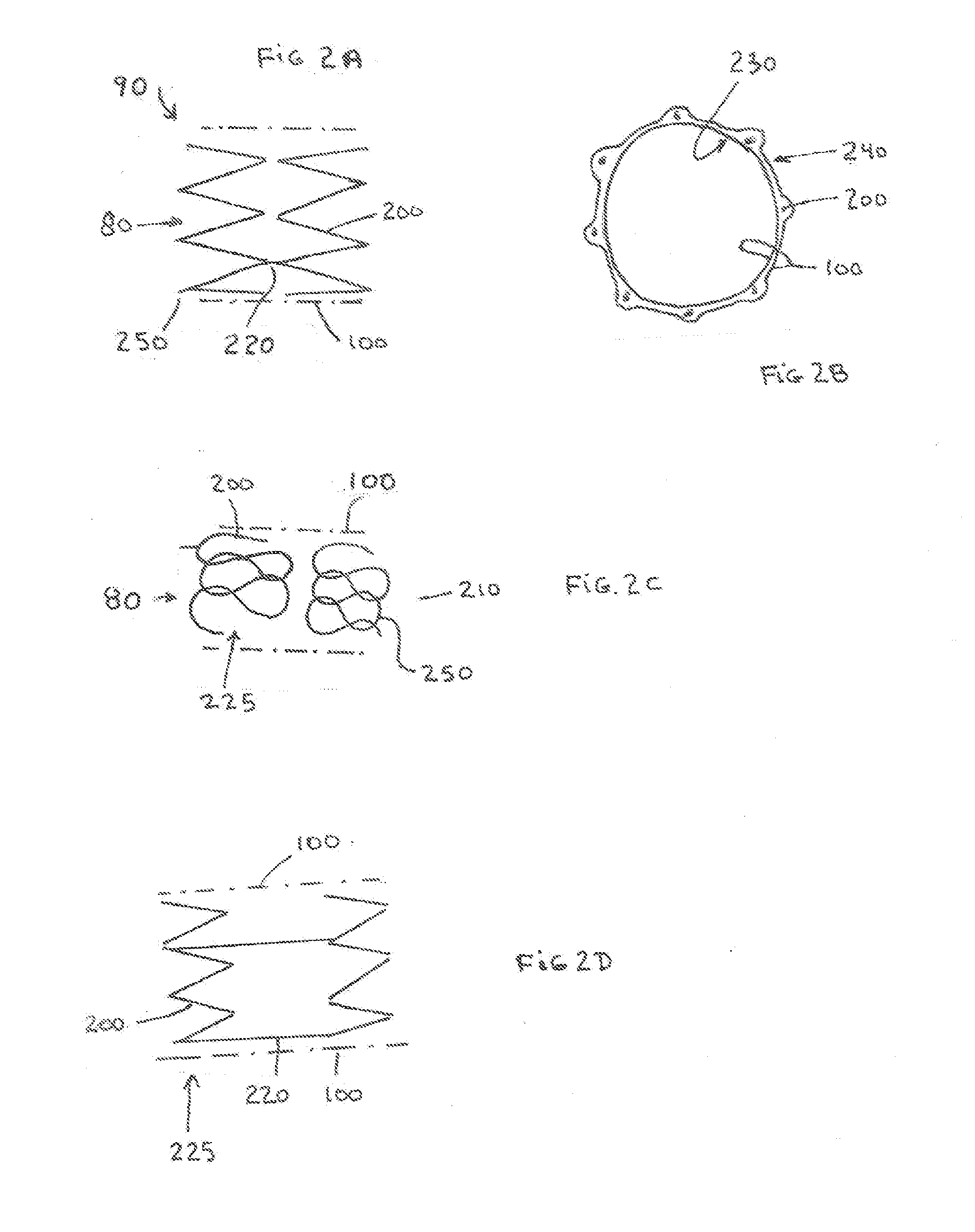 Large Vessel Closure Device and Method