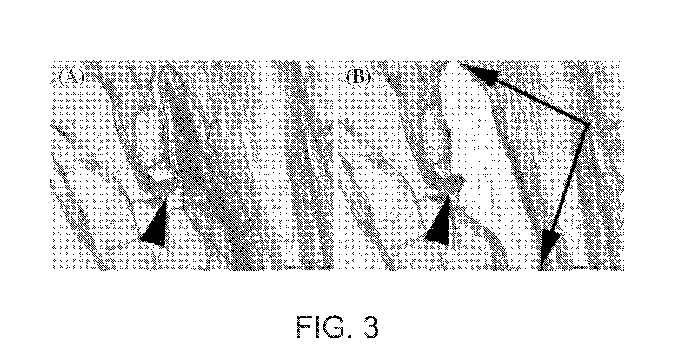 System and method for cell-type specific comparative analyses of different genotypes to identify resistance genes