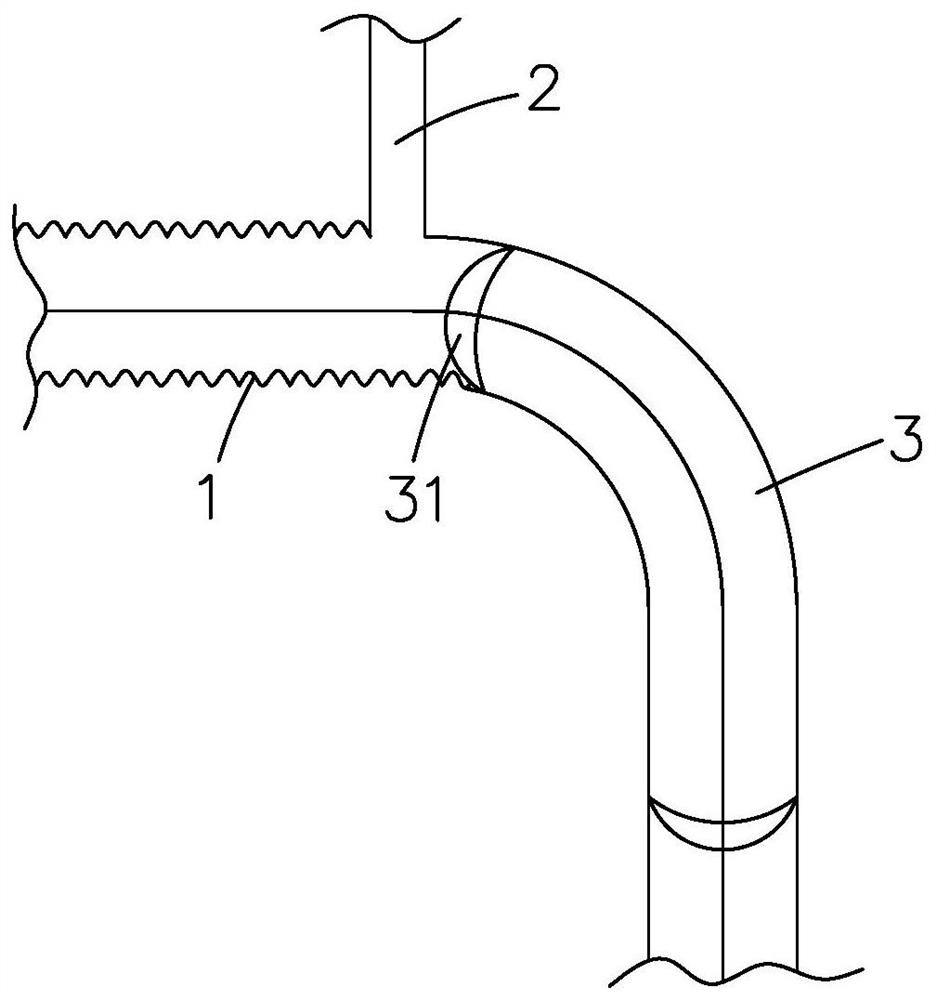 A kind of compound intraoperative stent system and using method thereof
