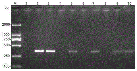 PCR detection primer and method for anoectochilus roxburghii colletotrichum orbiculare