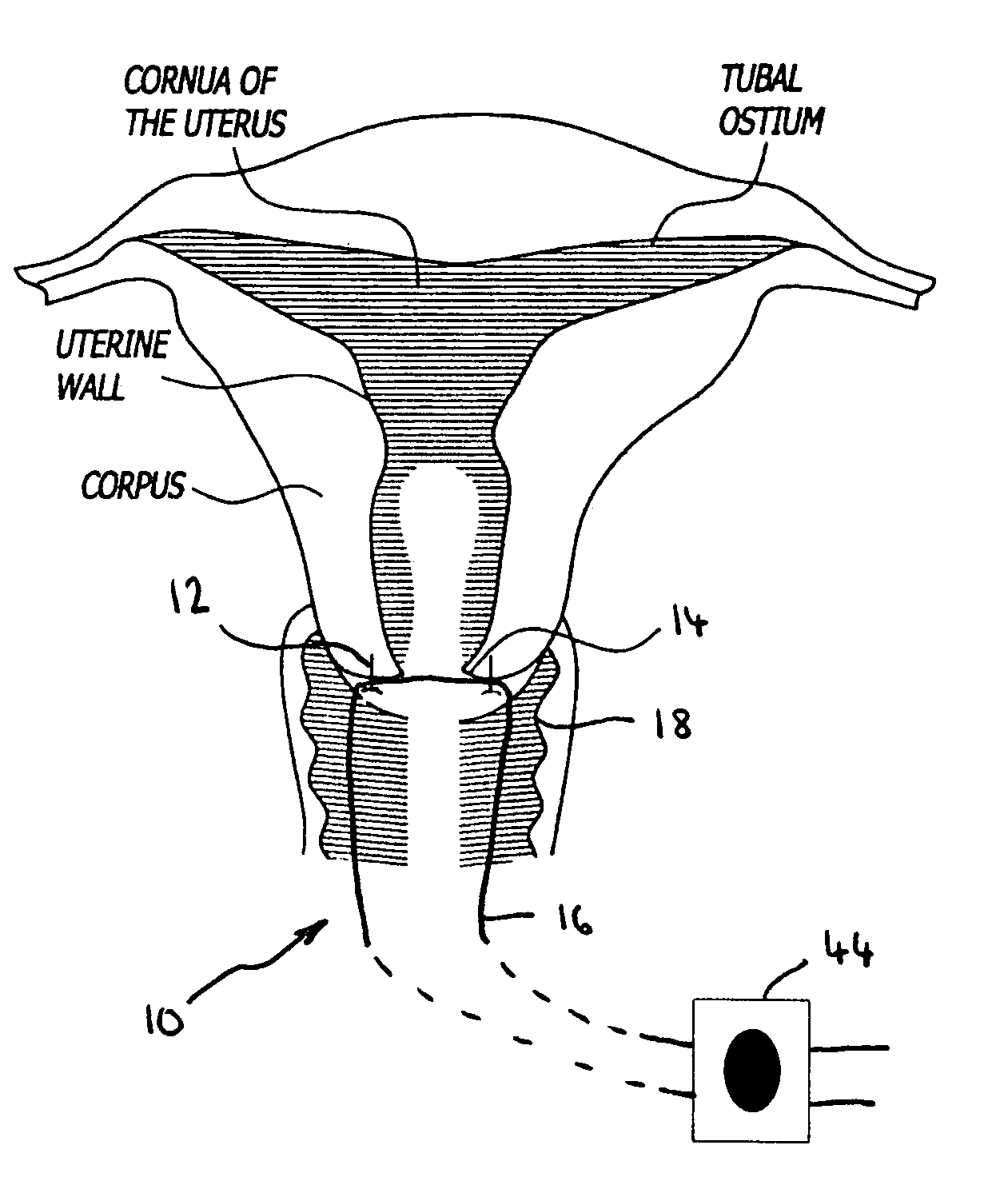 Systems and methods for measuring cervical dilation