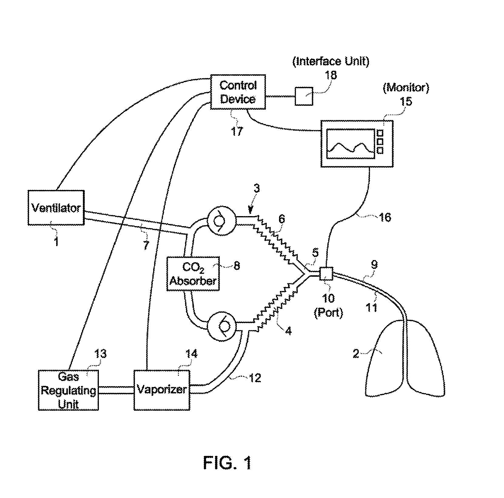 Inhalation anaesthesia delivery system and method