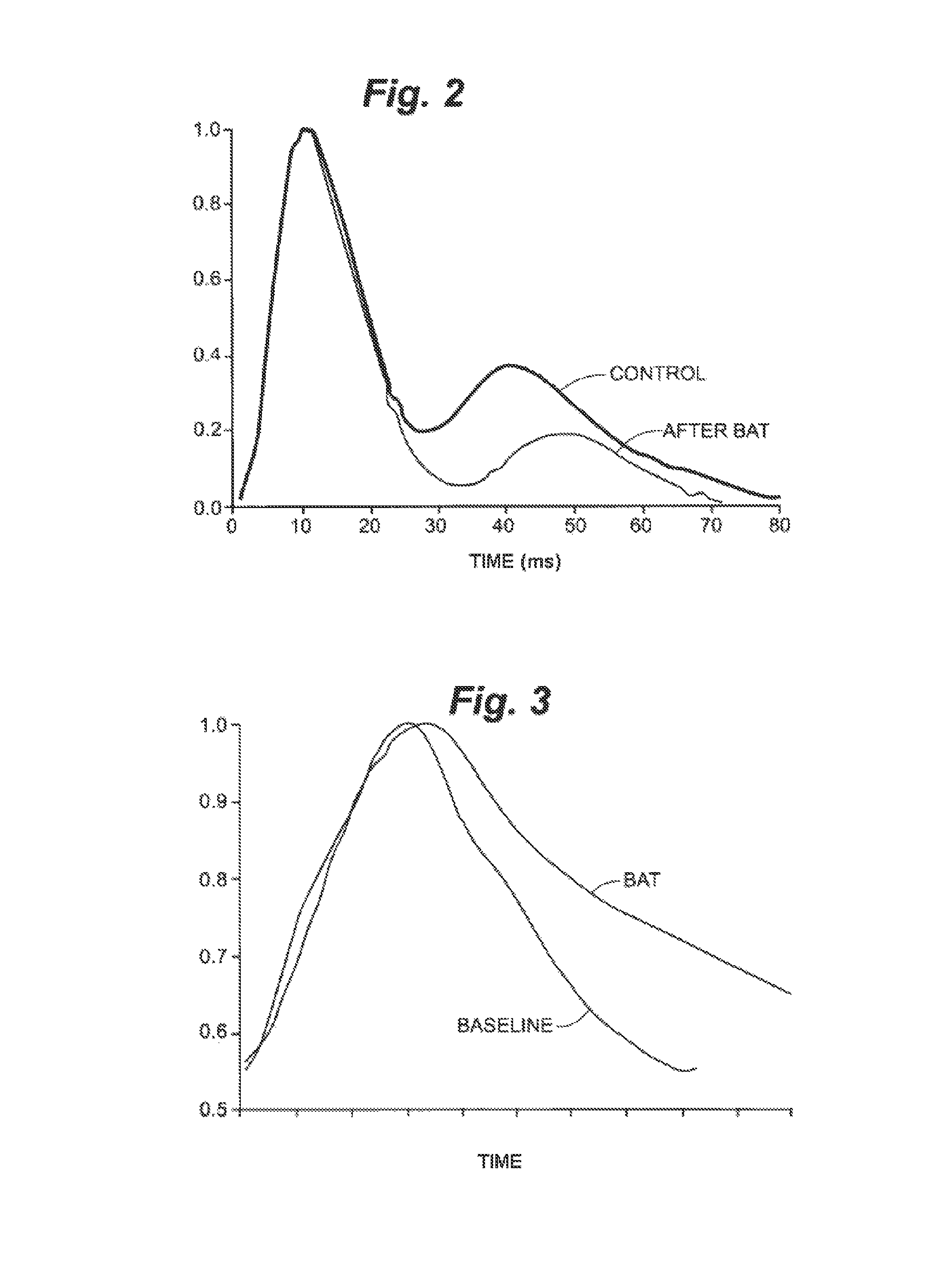 Devices and methods for treatment of heart failure and associated conditions