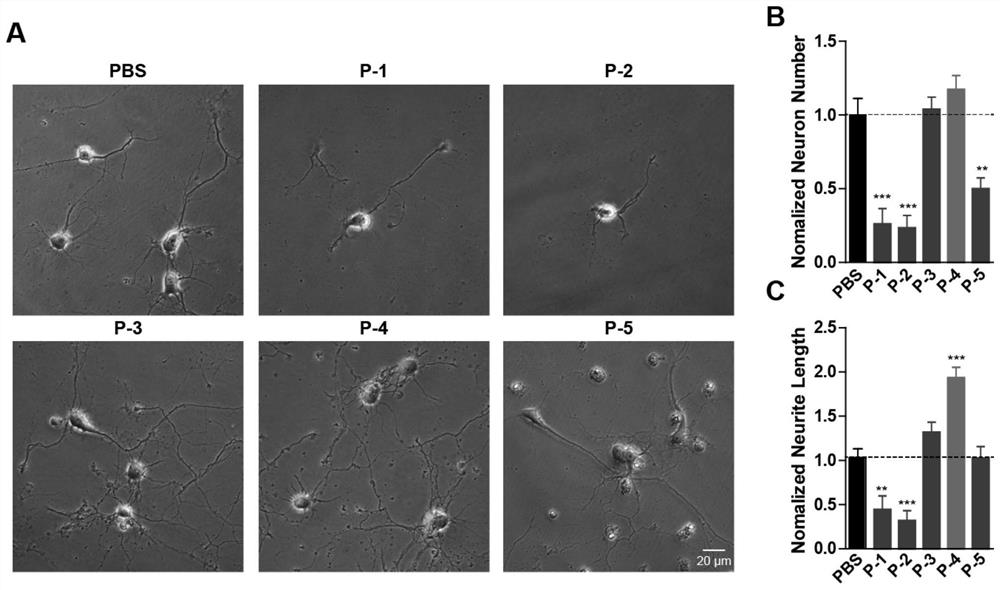 A plasma protein isolate for treating Alzheimer's disease and its preparation method and application
