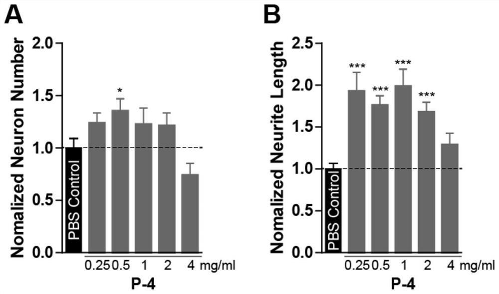 A plasma protein isolate for treating Alzheimer's disease and its preparation method and application