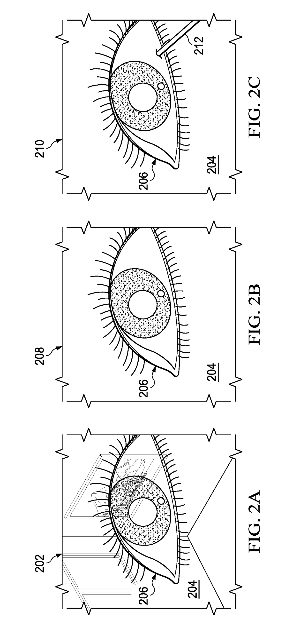 Systems and method for augmented reality ophthalmic surgical microscope projection