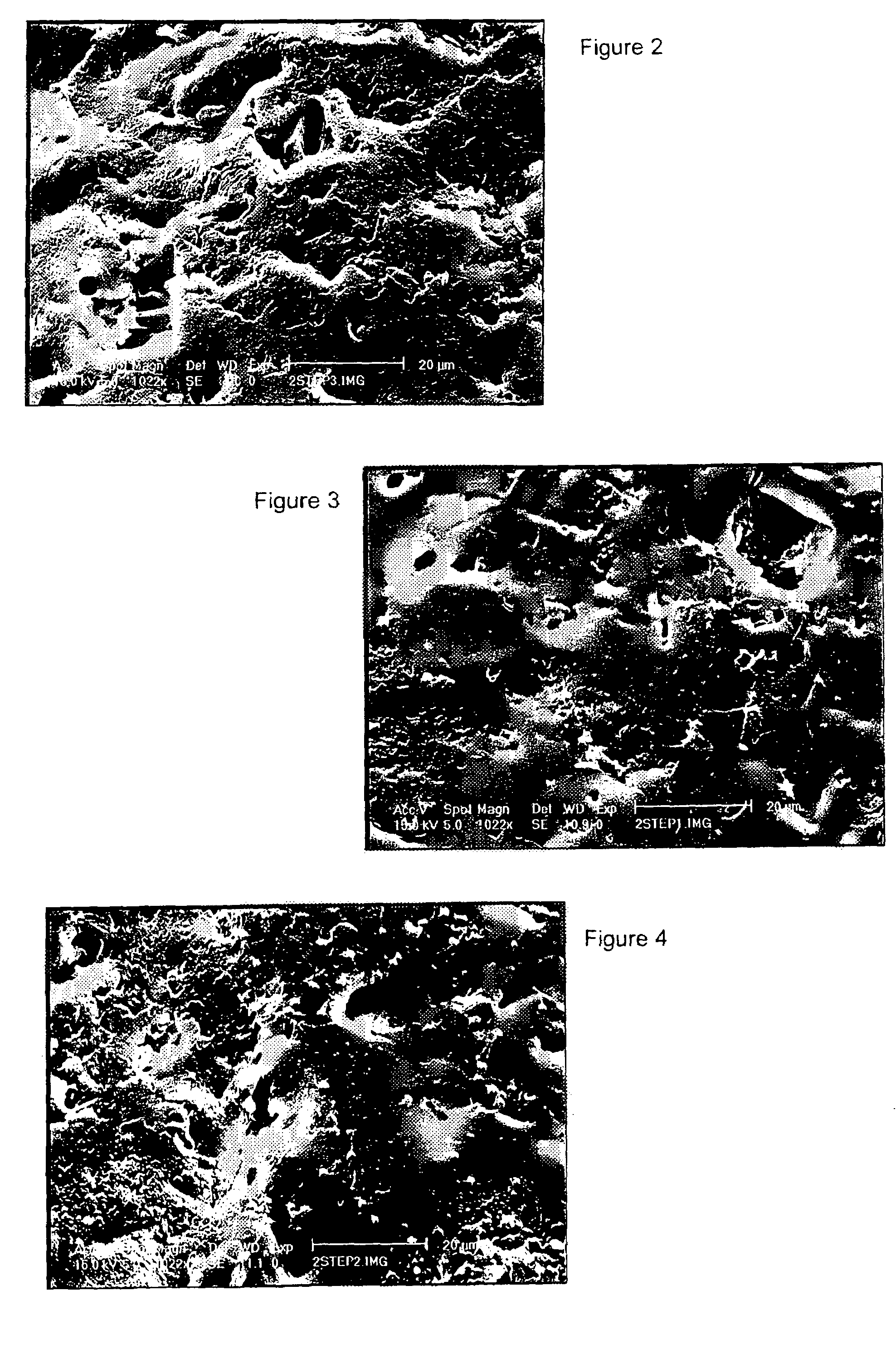 Sulphated hyaluronic acid and sulphated derivatives thereof covalently bound to polyurethanes, and the process for their preparation