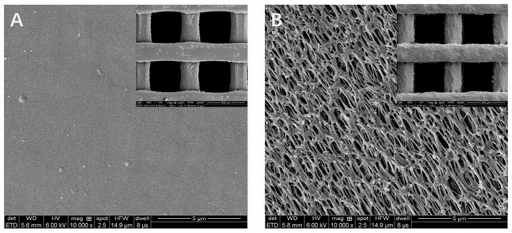 3D printed porous polyether-ether-ketone stent and preparation method and application of stent