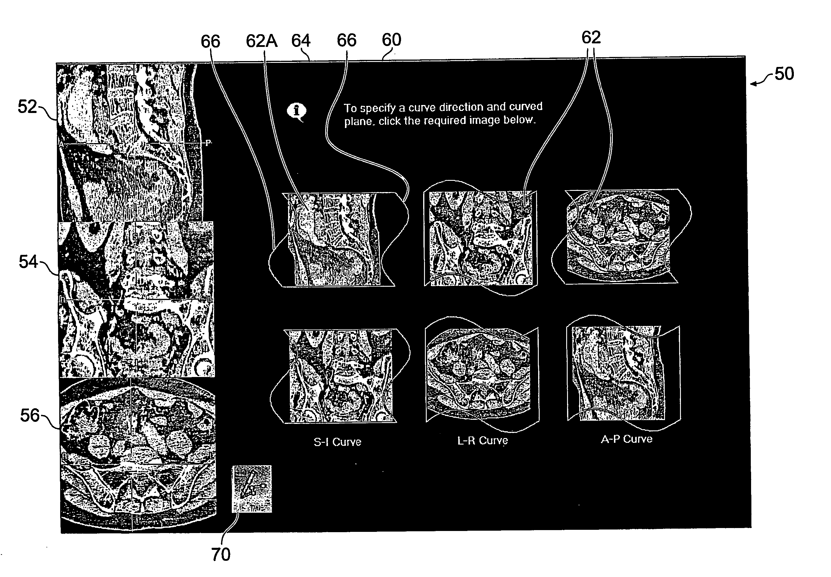 User-interface and method for curved multi-planar reformatting of three-dimensional volume data sets