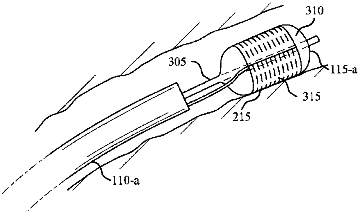 Systems and methods for ablative treatment of irritable bowel disease