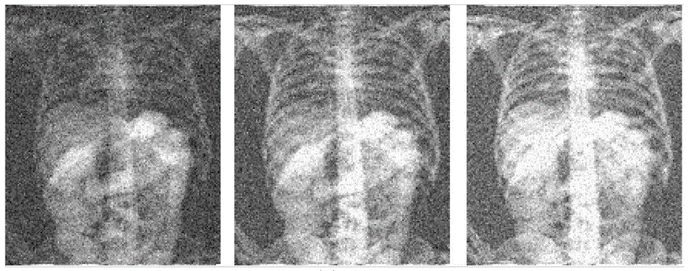 X-ray medical image objective reconstruction based on independent component analysis
