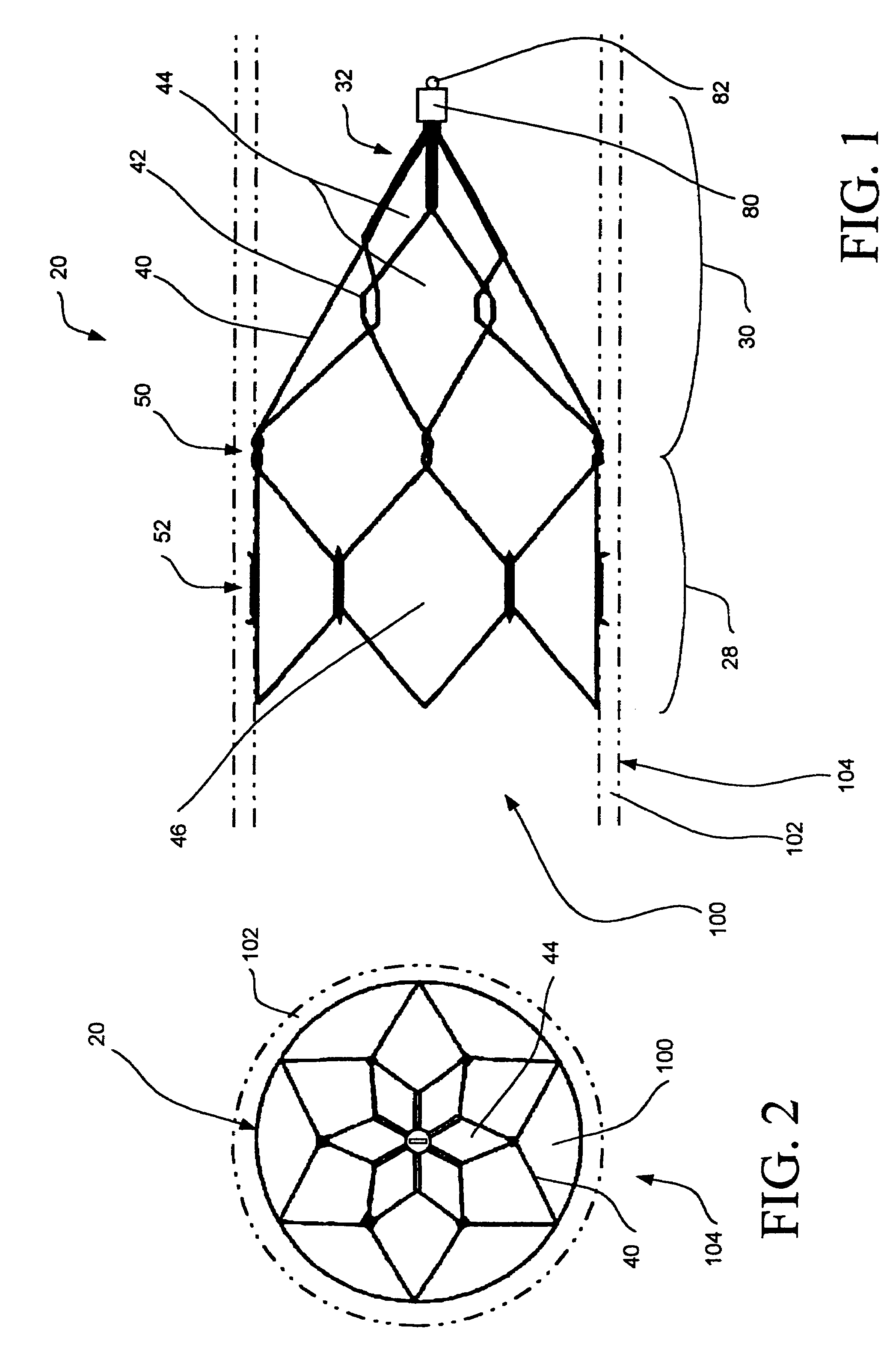 Intravascular filtering devices and methods