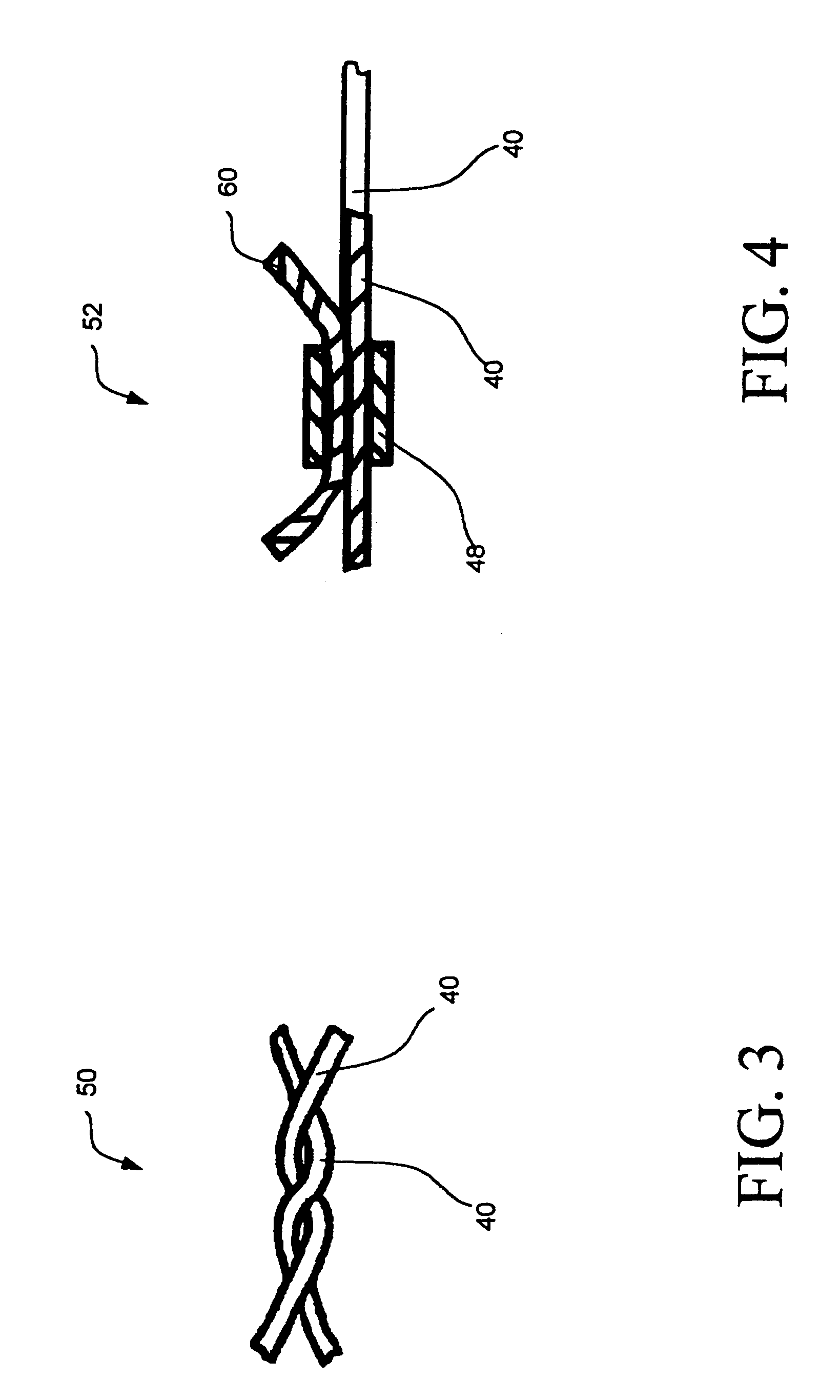 Intravascular filtering devices and methods