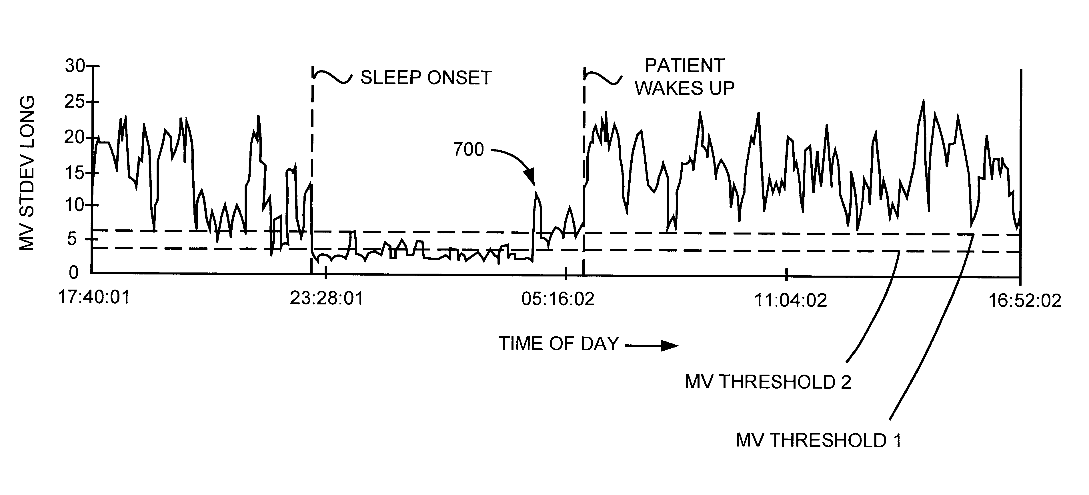 Method for providing a therapy to a patient involving modifying the therapy after detecting an onset of sleep in the patient, and implantable medical device embodying same