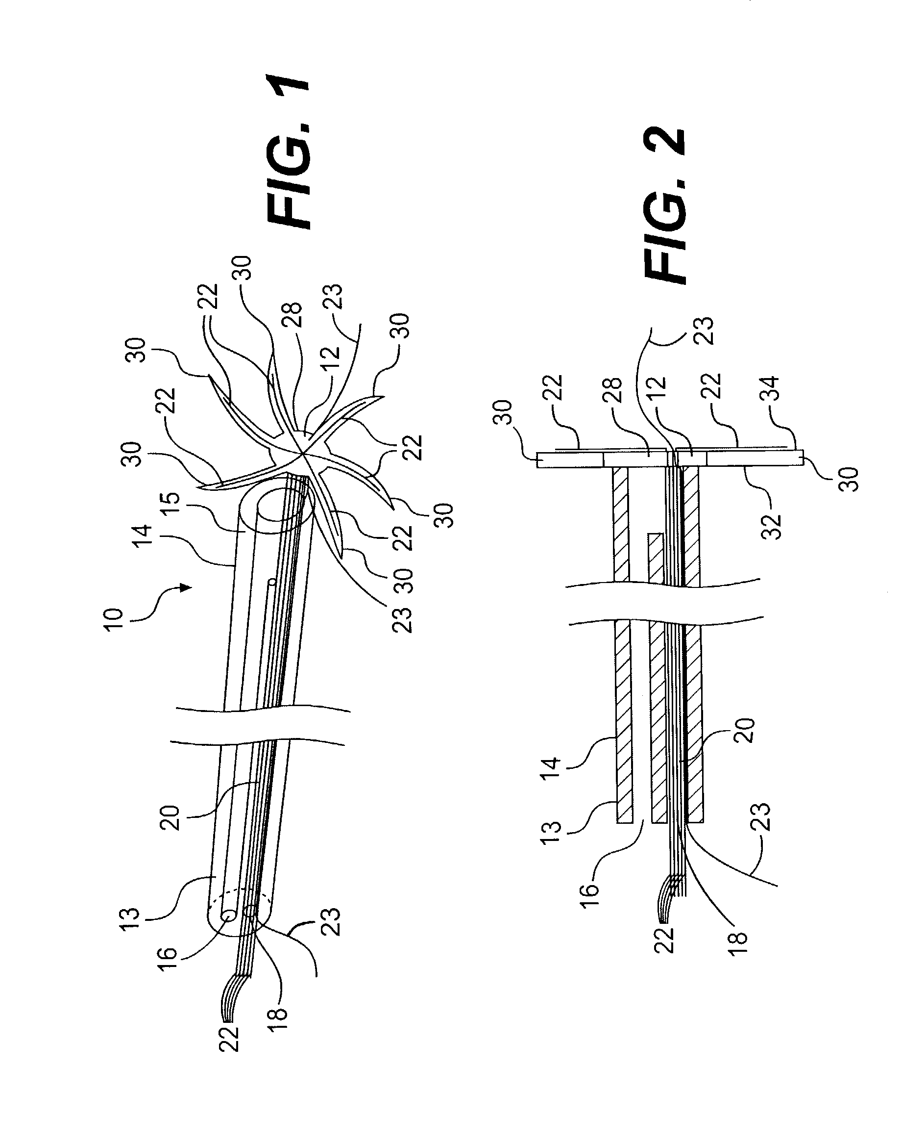 Implantable device for treating atrial fibrillation and method of using same