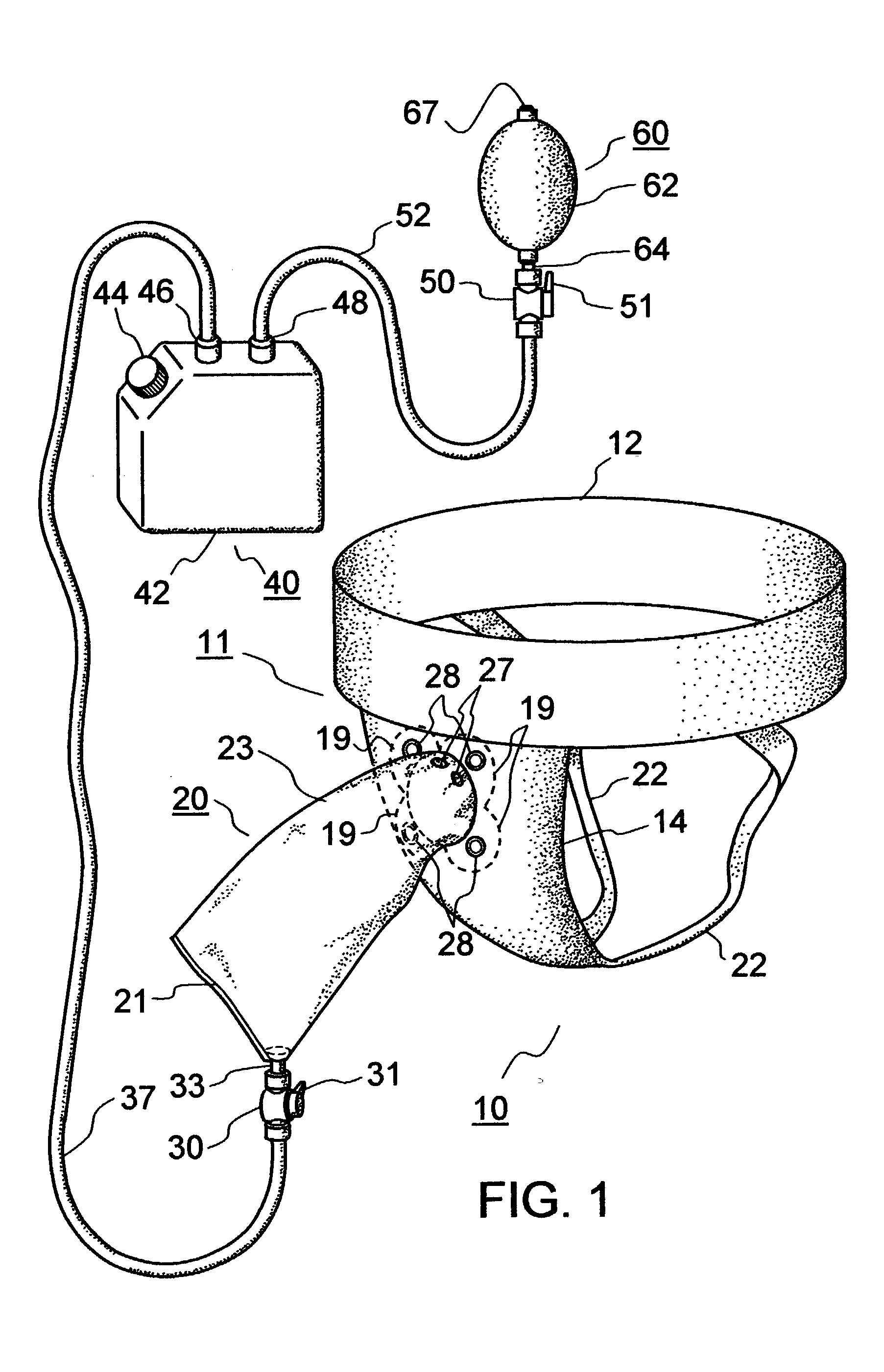 Urine collection system for males utilizing a flexible external catheter and vacuum assistance