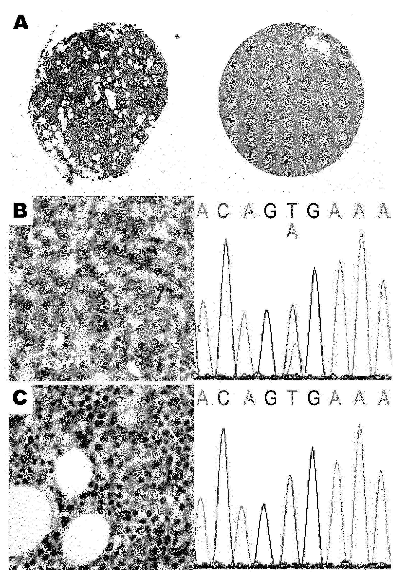 Means and methods for diagnosing cancer using an antibody which specifically binds to BRAF V600E