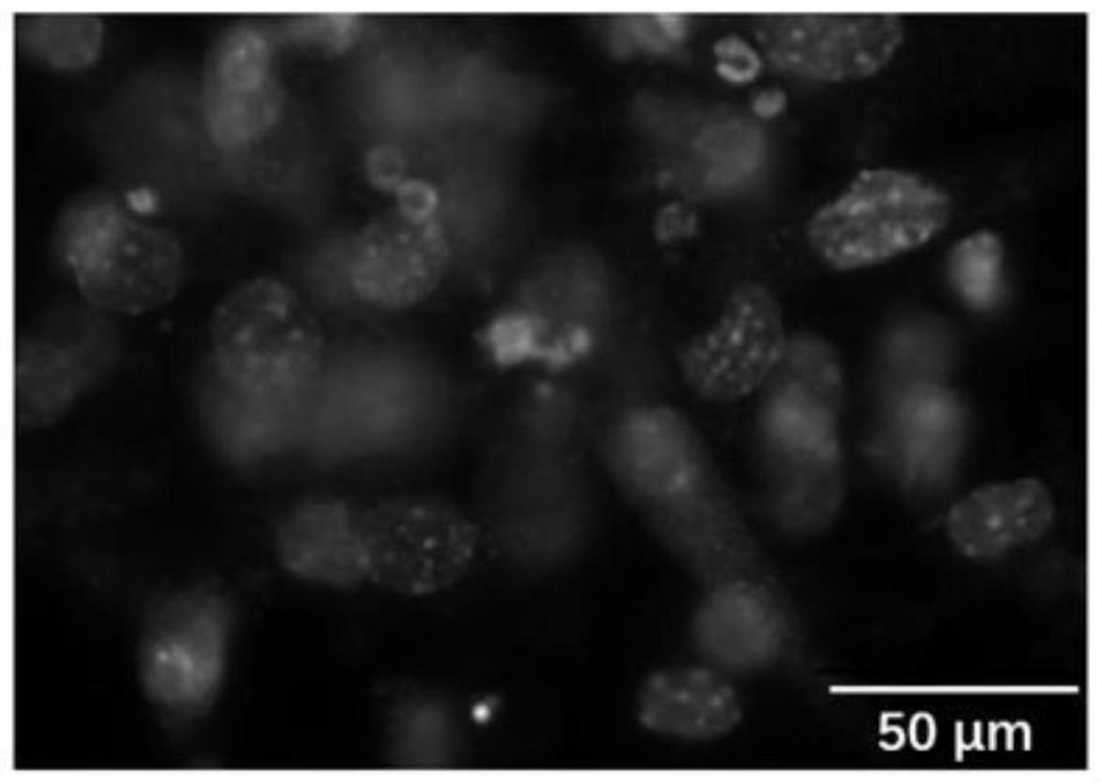 Chemical induction method for reprogramming dermal fibroblasts into endothelial progenitor cells