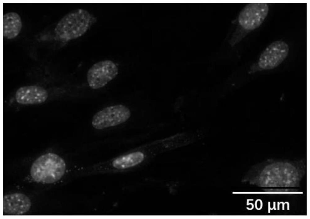 Chemical induction method for reprogramming dermal fibroblasts into endothelial progenitor cells