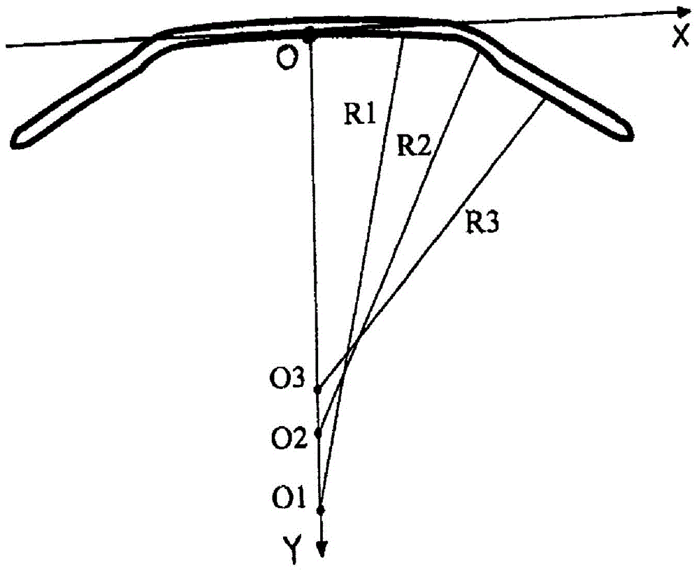 Orthokeratology