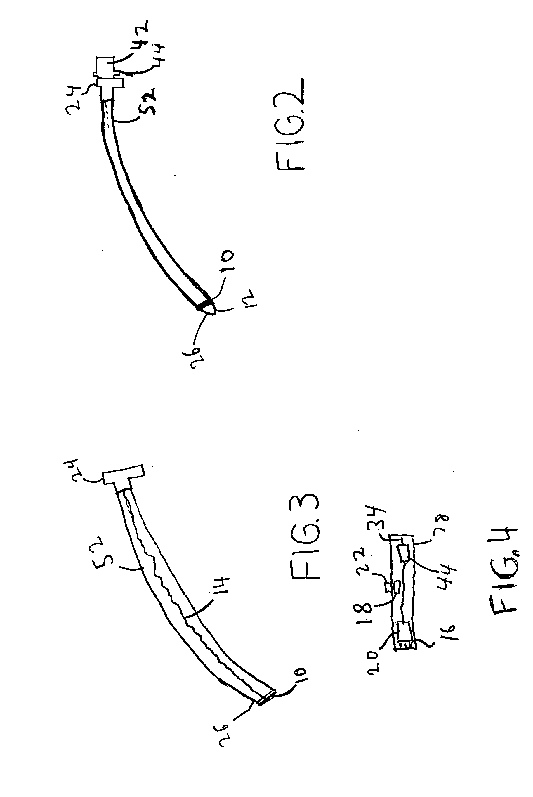 System and method for managing difficult airways