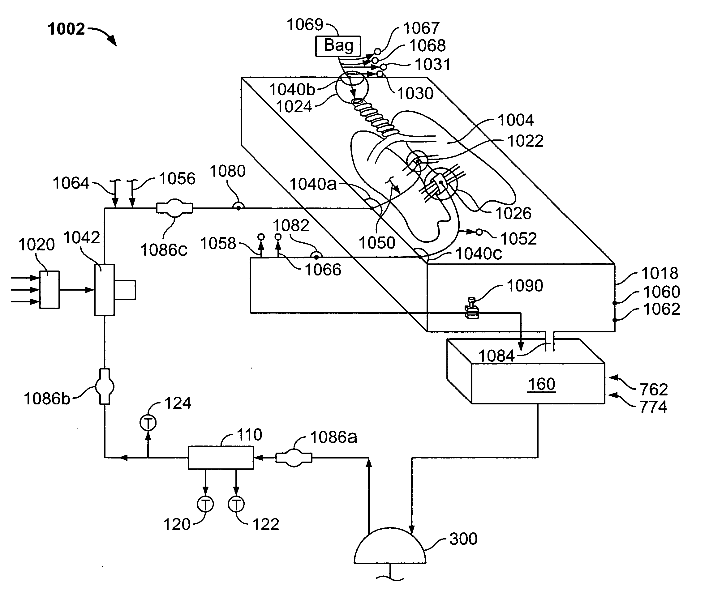 Systems and methods for ex vivo organ care