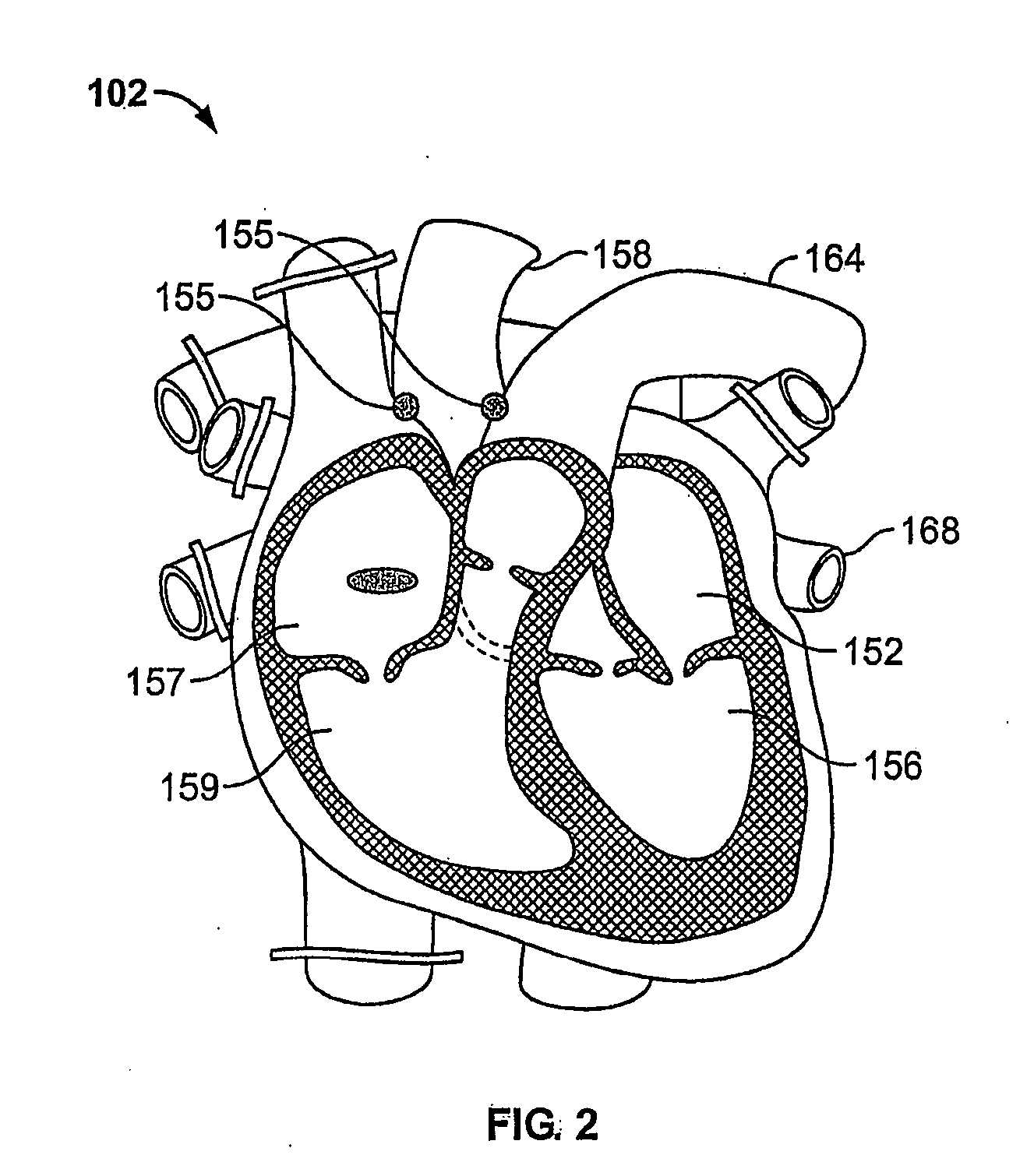 Systems and methods for ex vivo organ care