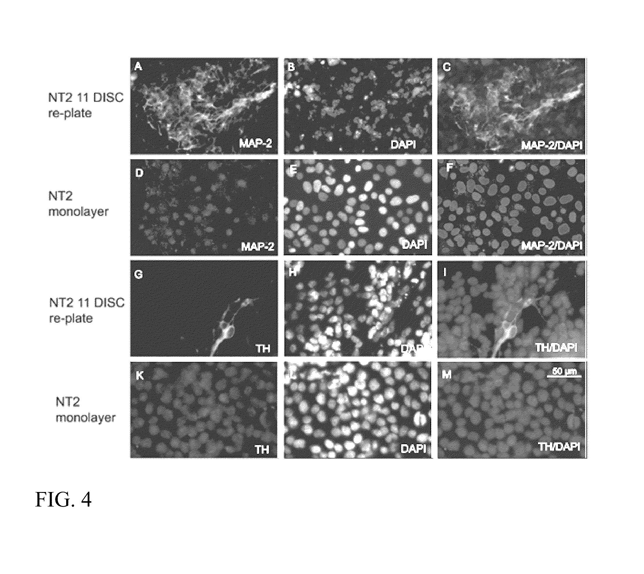 Stable differentiation of NT2 cells