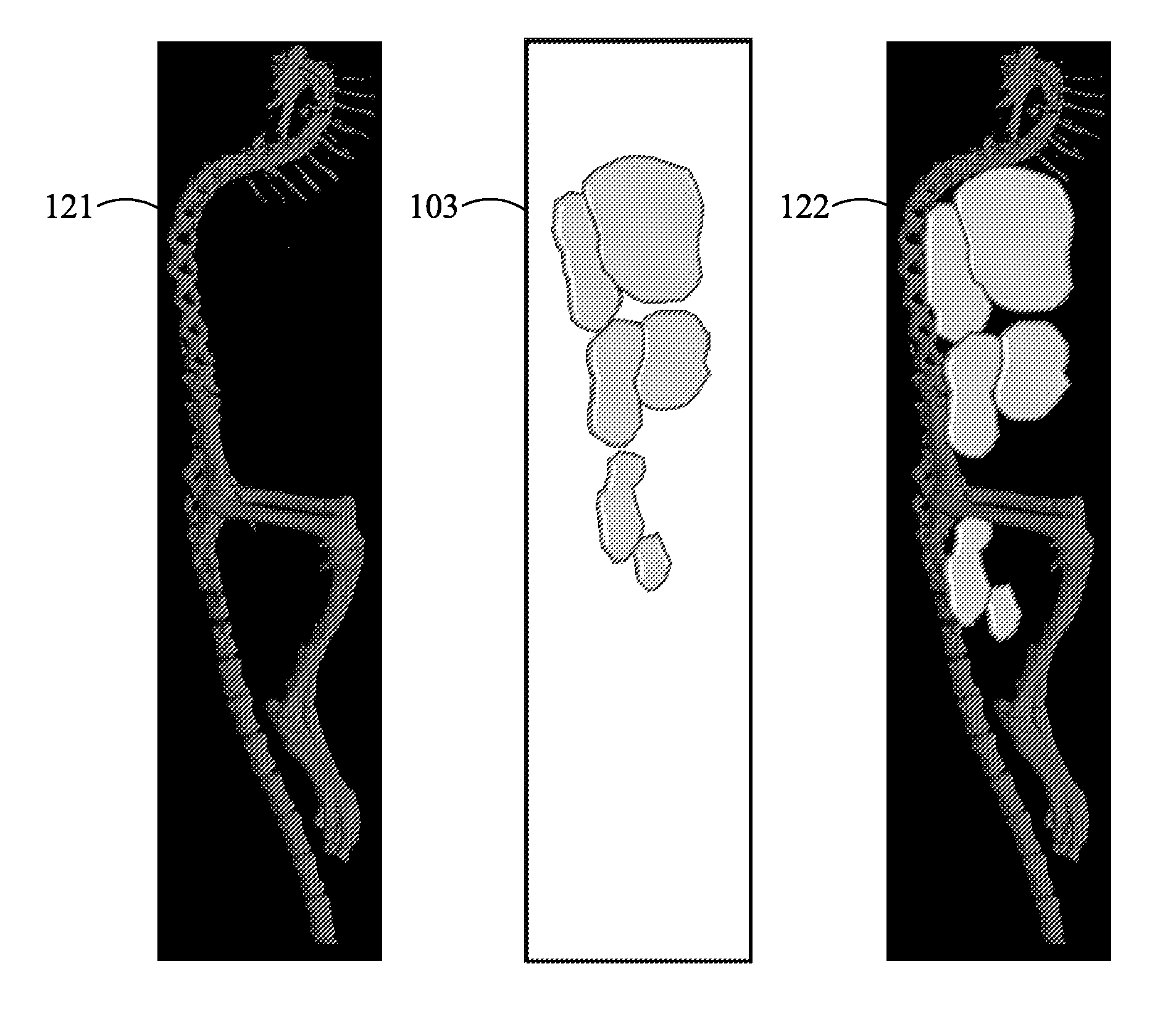 Volume-of-interest segmentation system for use with molecular imaging quantization