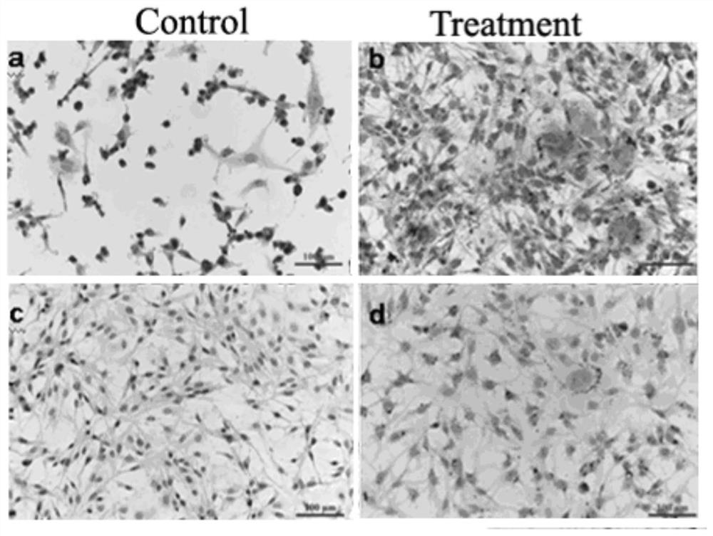 Use of dexamethasone, rosiglitazone, and 3-isobutyl-1-methylxanthine composition in the preparation of drugs for inhibiting the growth and metastasis of ovarian cancer cells induced by cobalt chloride