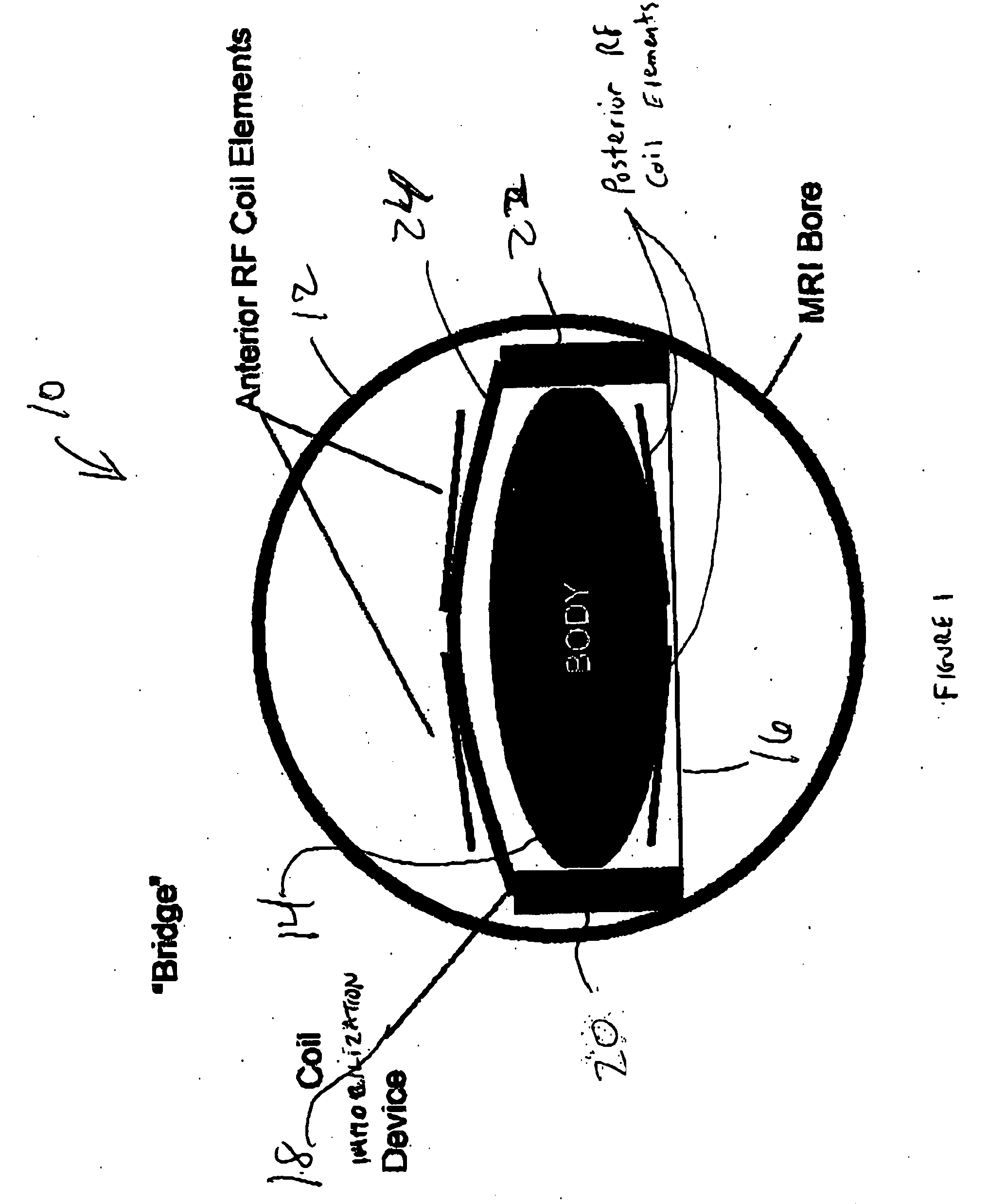 Device for enabling reduced motion-related artifacts in parallel magnetic resonance imaging