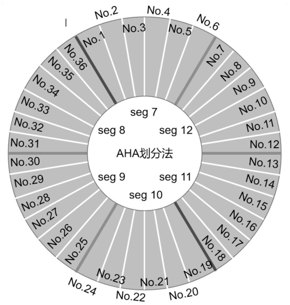 Myocardial fine-grained division method and system