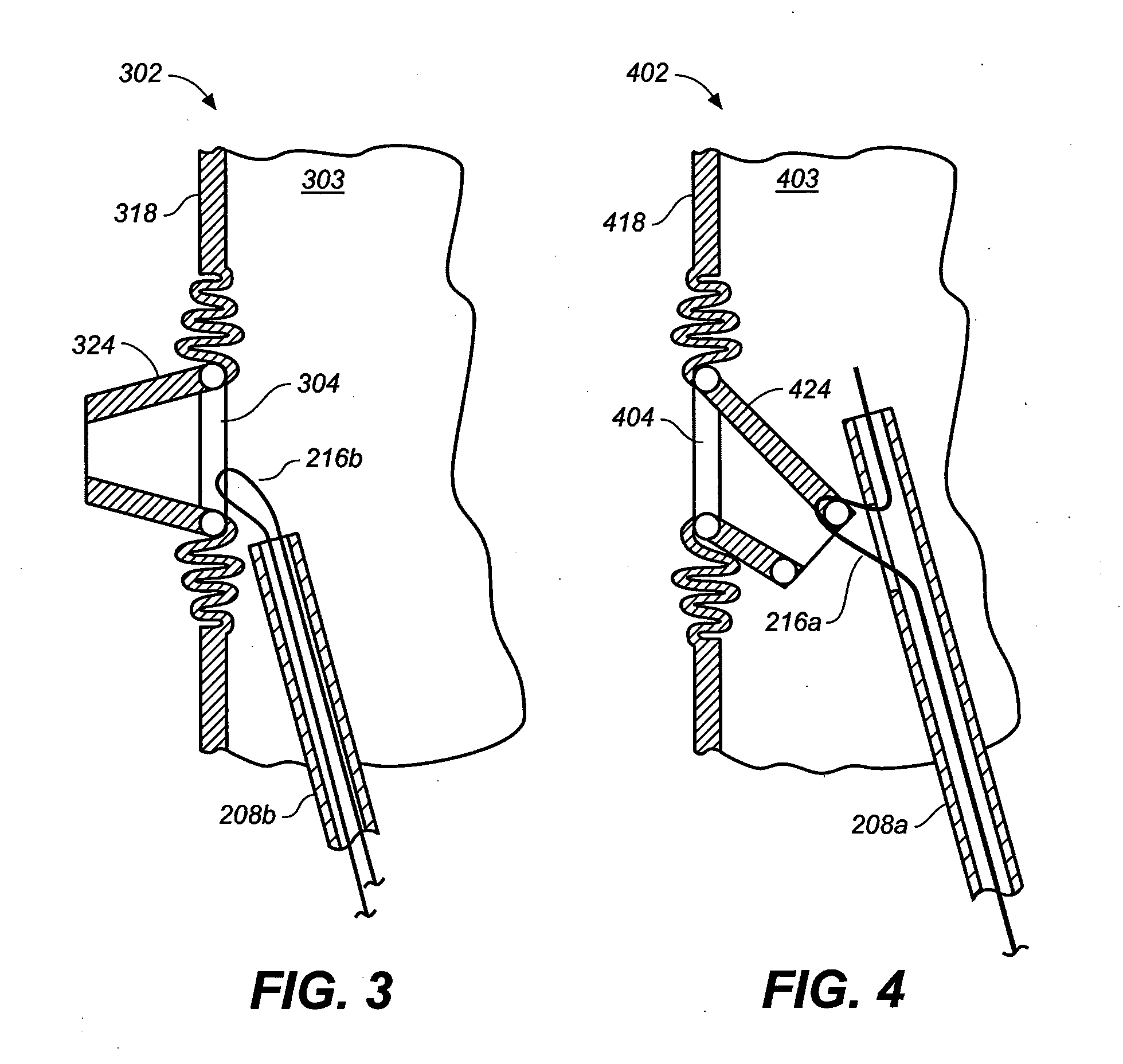 Device and Method for Controlling the Positioning of a Stent Graft Fenestration