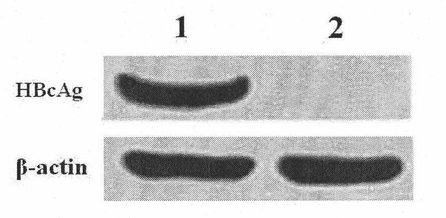 Composite of hepatitis B virus core antigen and heat shock protein and preparation method and application thereof