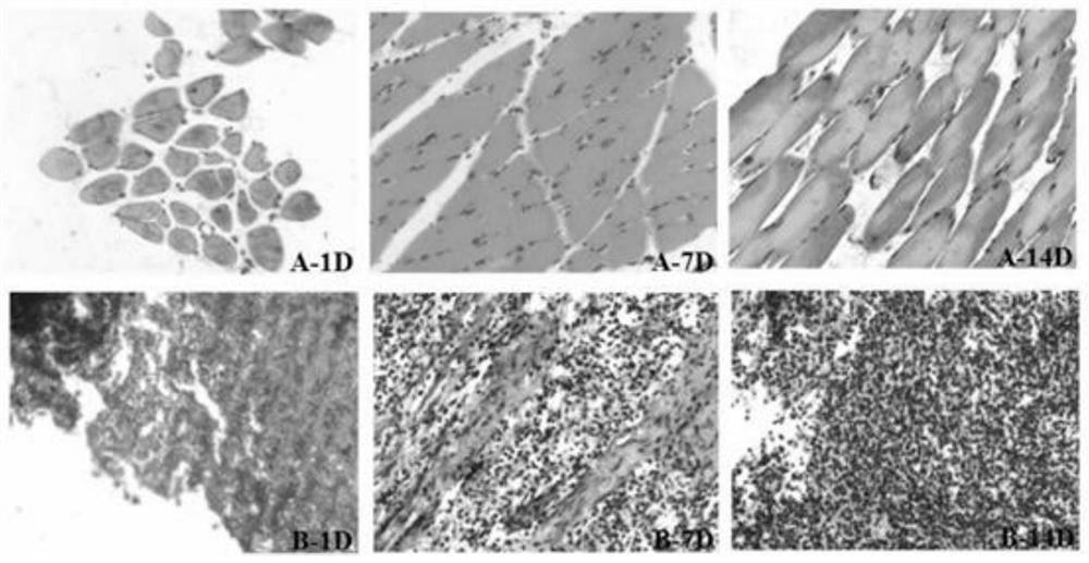 Progesterone suspension long-acting injection and preparation method thereof and progesterone suspension injection powder injection