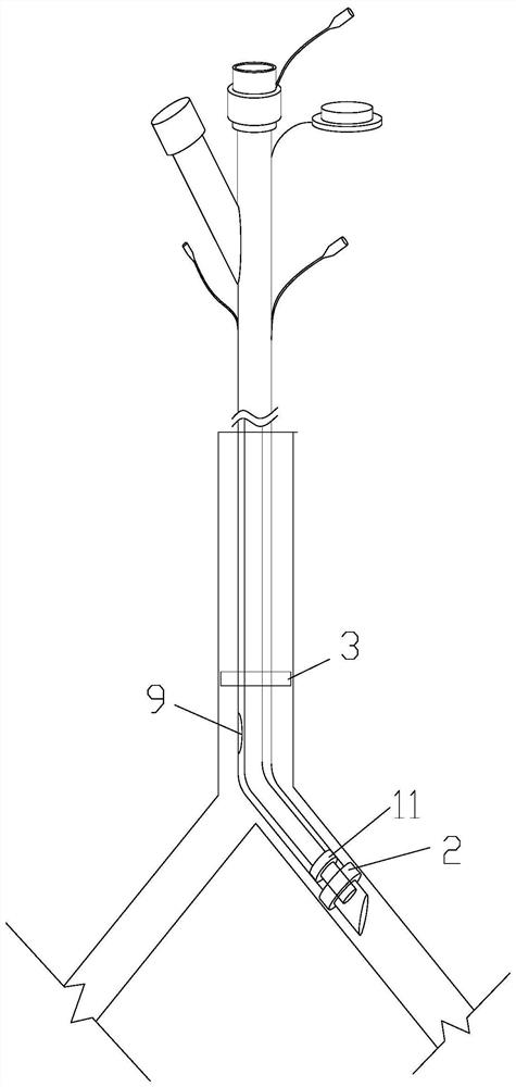 Sleeve type trachea cannula with variable pipe diameter